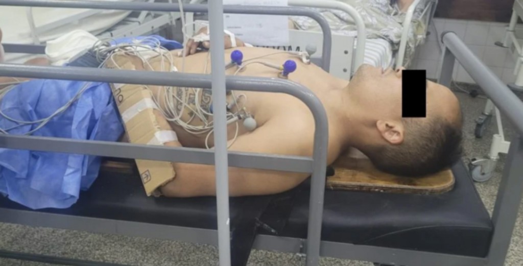 Intentó robarle el auto a una mujer policía en Mar del Plata y la pareja de la oficial le fracturó los dos brazos